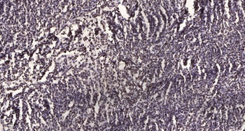 PP2A-B56-delta antibody