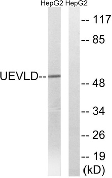UEV3 antibody