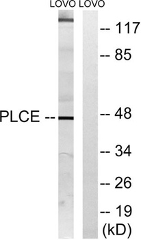 LPAAT-ε rabbit pAb Antibody