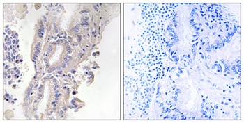 PLC-XD1 antibody