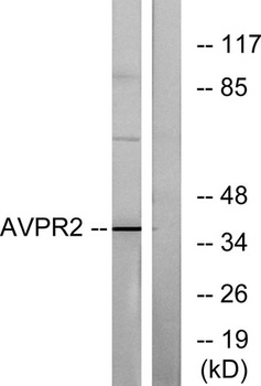 AVP Receptor V2 antibody