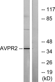 AVP Receptor V2 rabbit pAb