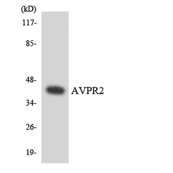 AVP Receptor V2 rabbit pAb