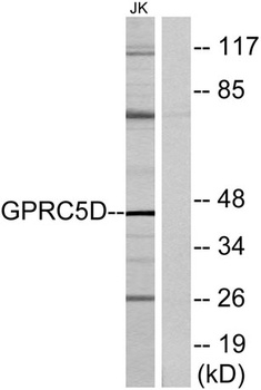 GPRC5D rabbit pAb