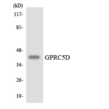 GPRC5D rabbit pAb