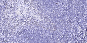 SUHW3 antibody