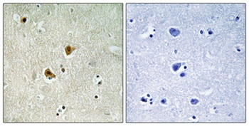 AMPKβ1 rabbit pAb