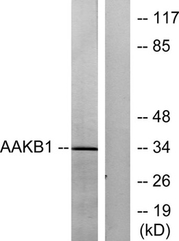 AMPKβ1 rabbit pAb