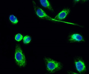 PKAα/β/γ cat (phospho Thr197) rabbit pAb Antibody