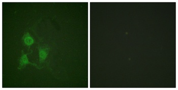 PKAα/β/γ cat (phospho Thr197) rabbit pAb Antibody