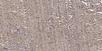 PKAβ cat rabbit pAb