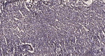 PKAγ cat rabbit pAb