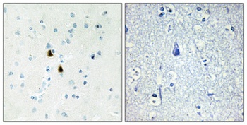 Pki alpha antibody