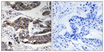 Girdin (phospho Ser1417) rabbit pAb