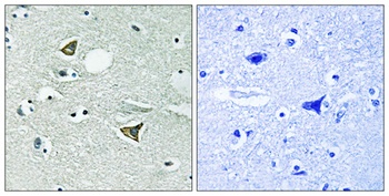 Girdin rabbit pAb Antibody