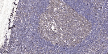 ASF1B antibody