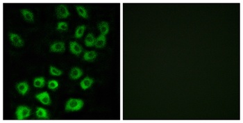 ARF GAP1 antibody