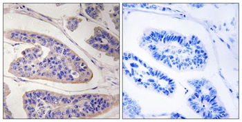 Mena antibody