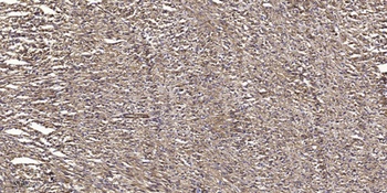 PKA II alpha reg antibody