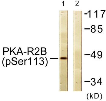 PKA II beta reg (phospho-Ser113) antibody