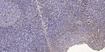 NY-REN-50 rabbit pAb Antibody