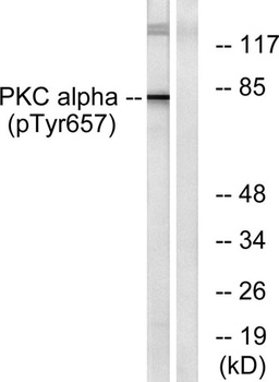 PKC alpha (phospho-Tyr657) antibody