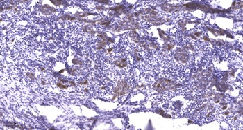 PKC α (phospho Tyr658) rabbit pAb