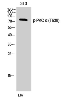 PKC α (phospho Thr638) rabbit pAb Antibody