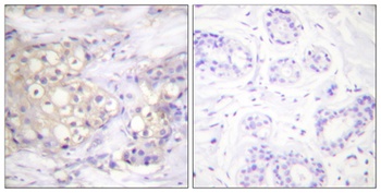 PKC α (phospho Thr638) rabbit pAb