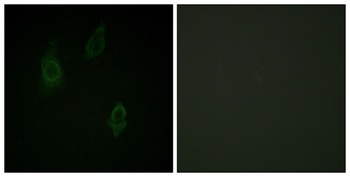PKC (phospho Thr497) rabbit pAb