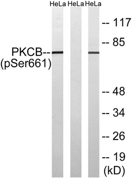 PKC β (phospho Ser661) rabbit pAb