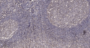 PKC β (phospho Ser661) rabbit pAb