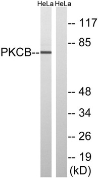 PKC β rabbit pAb