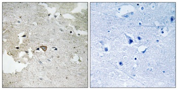 Axl (phospho Tyr691) rabbit pAb