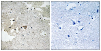 Axl (phospho-Tyr691) antibody