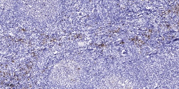 Axl rabbit pAb Antibody