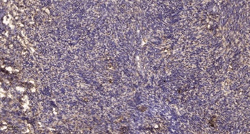 PKC δ (phospho Tyr64) rabbit pAb