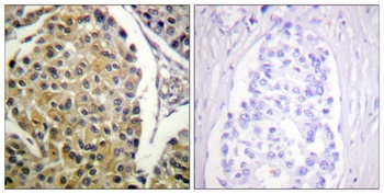 PKC δ (phospho Tyr313) rabbit pAb