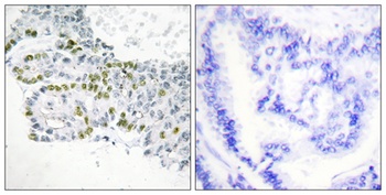 PKC delta (phospho-Tyr52) antibody