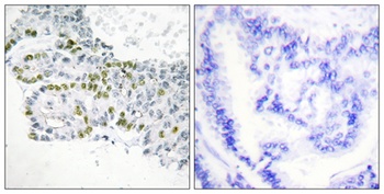 PKC δ (phospho Tyr52) rabbit pAb
