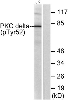PKC delta (phospho-Tyr52) antibody