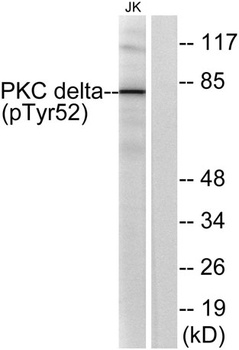 PKC δ (phospho Tyr52) rabbit pAb