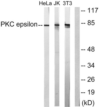 PKC ε rabbit pAb