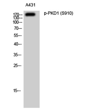 PKD1 (phospho Ser910) rabbit pAb