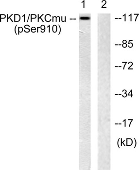 PKD1 (phospho Ser910) rabbit pAb
