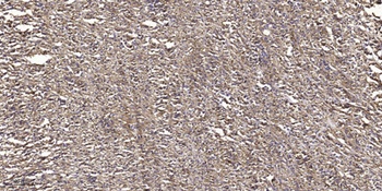 PKD1 (phospho Ser910) rabbit pAb