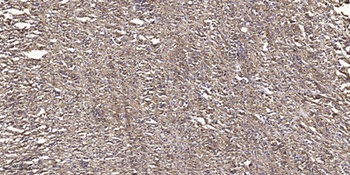 PKD1 (phospho-Ser910) antibody