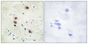 PKD1 (phospho Ser205) rabbit pAb