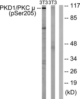 PKD1 (phospho-Ser205) antibody