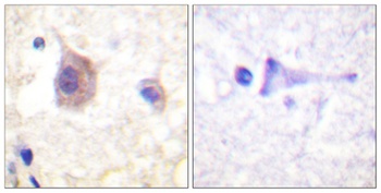 PKD1 (phospho Tyr463) rabbit pAb